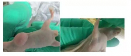 裸鼠成瘤尝试