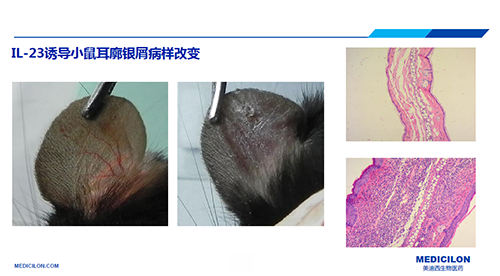 白介素IL-23诱导的幼鼠耳廓银屑病样扭转