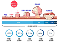 直肠癌早筛试剂河装第一证”—走南闯北而明察秋毫