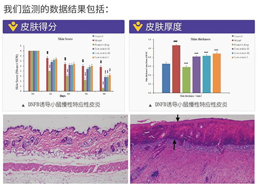 JDB电子成立的特应性皮炎及湿疹模型监测数据了局