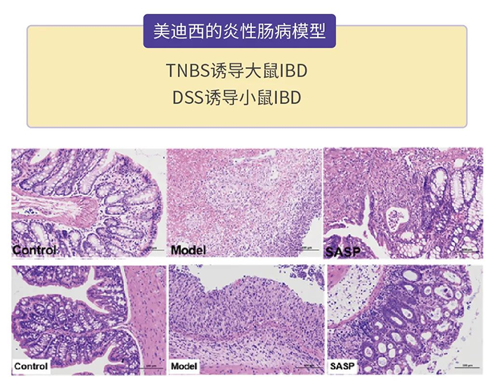 JDB电子的炎性肠病模型.png